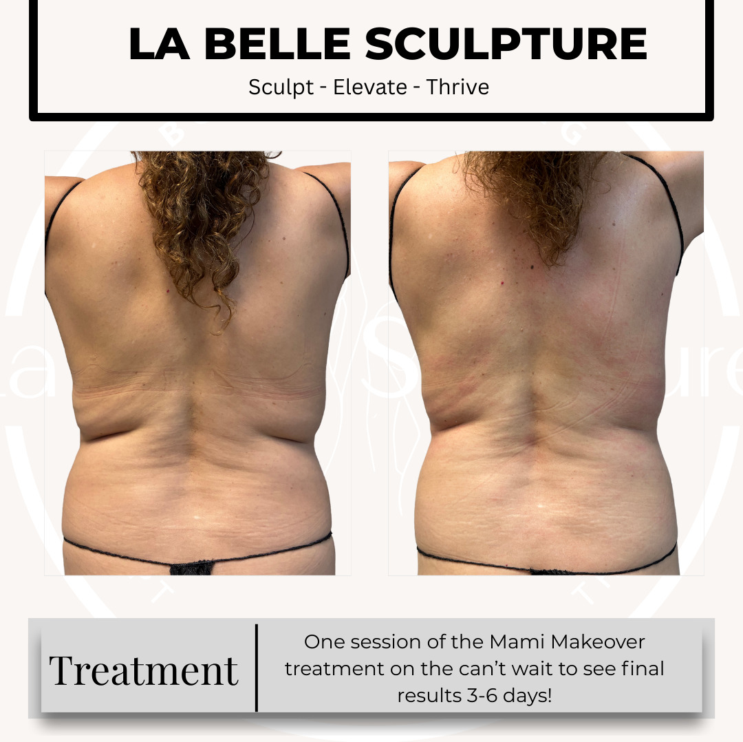 Before and after — Mami Makeover, back